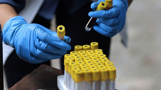 Your Age May Influence Antibody Production In Response To A Virus: Study