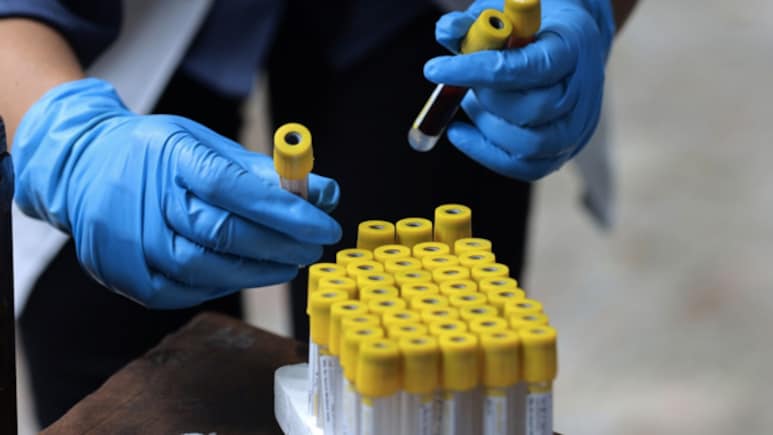 Your Age May Influence Antibody Production In Response To A Virus: Study