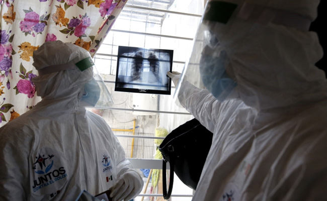 Double-Lung Transplants Rise After Covid 'Honeycombs' Organs: Study