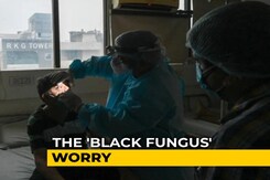 Black Fungus Cases Grow 150% In 3 Weeks To 31,000, Deaths Over 2,100 Black Fungus Cases Grow 150% In 3 Weeks To 31,000, Deaths Over 2,100
