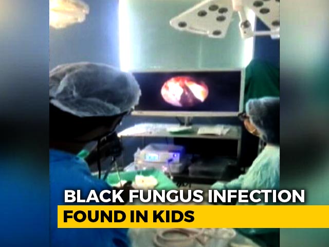 Eyes Of 3 Children Infected With Black Fungus Removed In Mumbai