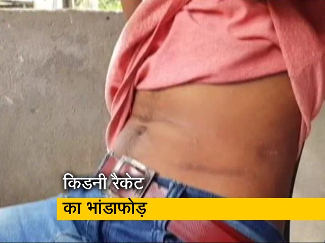 किडनी बेचकर कर्ज चुका रहे लोग, असम में सक्रिय था किडनी रैकेट