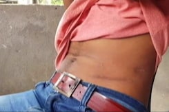 Organs For Sale: Lockdown-Hit Assam Villagers Sell Kidneys To Repay Loans Organs For Sale: Lockdown-Hit Assam Villagers Sell Kidneys To Repay Loans