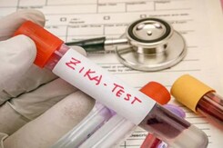 5 More People Test Positive For Zika Virus In Kerala, Caseload Reaches 28 5 More People Test Positive For Zika Virus In Kerala, Caseload Reaches 28