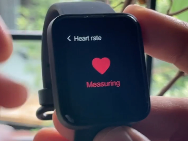 Redmi Watch: Top 5 Reasons to Buy