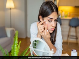 Monsoon Skincare: Tips And Tricks On How To Treat Monsoon Acne At Home Monsoon Skincare: Tips And Tricks On How To Treat Monsoon Acne At Home
