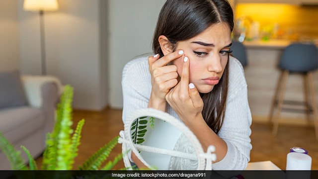 Skincare tips: Improper techniques of shaving or waxing or plucking may lead to ingrown hair