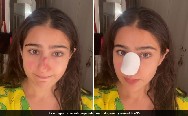 "Knock Out": Sara Ali Khan Reveals Nose Injury With A Message For Saif Ali Khan, Amrita Singh