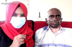 Patient On ECMO Support For 62 Days In Chennai Recovers Patient On ECMO Support For 62 Days In Chennai Recovers