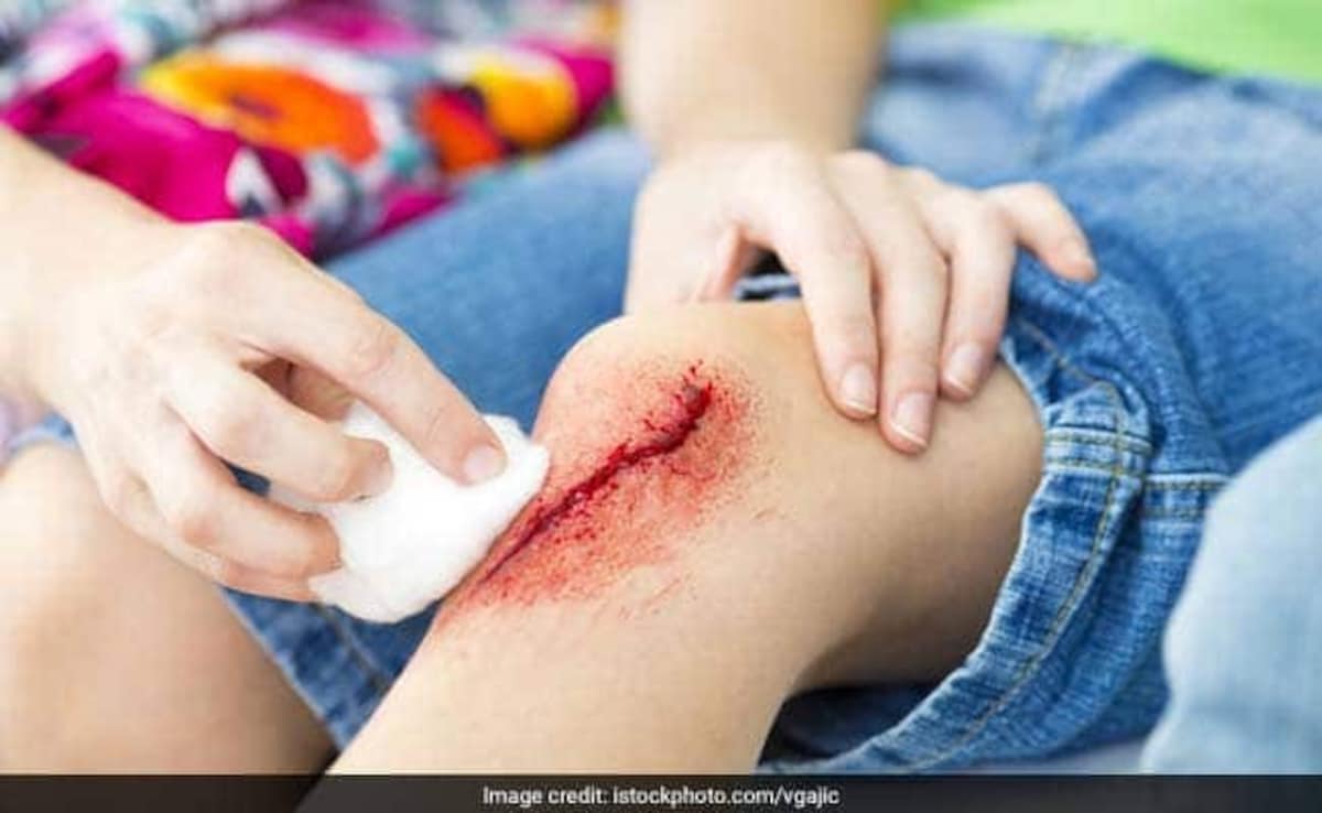 Latest and Breaking News on NDTV