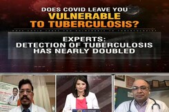 Does Covid Leave You Vulnerable To Tuberculosis? Does Covid Leave You Vulnerable To Tuberculosis?