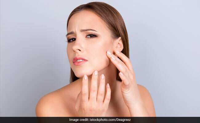 Skin Care Tips: साफ और एक्ने-फ्री स्किन चाहते हैं तो डाइट में आज से ही शामिल करें ये 6 चीजें