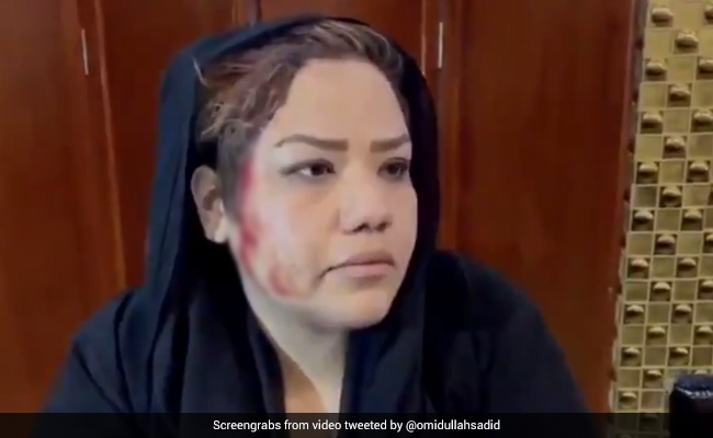 Afghan Woman Activist Beaten Up By Taliban During Kabul Protest: Report