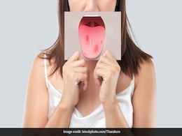High Blood Sugar Disease: बार-बार मुंह सूखना, जीभ में जलन या छाले इस खतरनाक बीमारी के लक्षण, समय रहते हो जाएं अलर्ट High Blood Sugar Disease: बार-बार मुंह सूखना, जीभ में जलन या छाले इस खतरनाक बीमारी के लक्षण, समय रहते हो जाएं अलर्ट