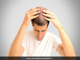 Foods for Hair Loss: बाल झड़ रहे हैं? बालों को मजबूत, घना और काला बनाने के लिए खाएं ये चीजें... Foods for Hair Loss: बाल झड़ रहे हैं? बालों को मजबूत, घना और काला बनाने के लिए खाएं ये चीजें...