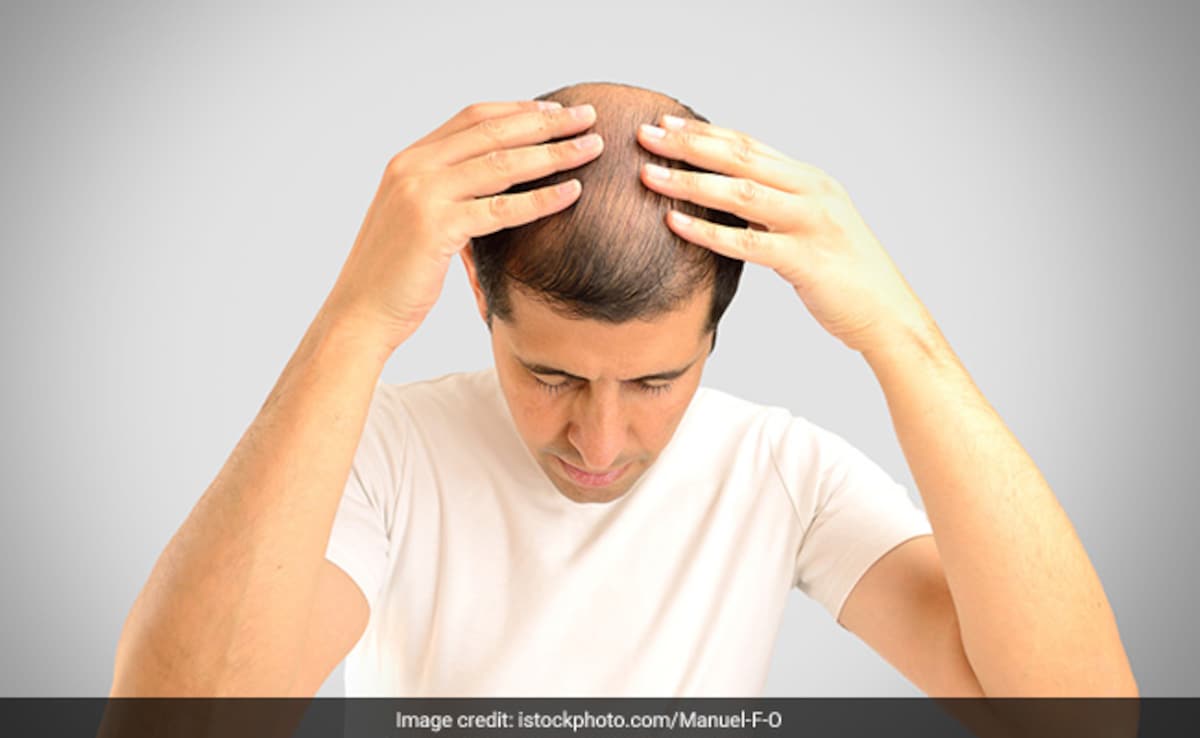 गर्मी में बालों का झड़ना रोकने के लिए 5 बेस्ट हेयर ऑयल, तेजी से बढ़ेगी ग्रोथ और मजबूत होंगी जड़ें