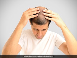 गर्मी में बालों का झड़ना रोकने के लिए 5 बेस्ट हेयर ऑयल, तेजी से बढ़ेगी ग्रोथ और मजबूत होंगी जड़ें