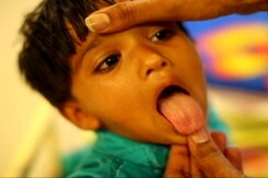 The Need To Break The Relentless Cycle Of Malnutrition And Diarrhoea In India The Need To Break The Relentless Cycle Of Malnutrition And Diarrhoea In India