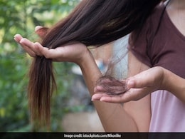Health Tips : क्या Hair Fall और Hair Loss एक ही बात है, जानिए इससे कैसे बचा जाए Health Tips : क्या Hair Fall और Hair Loss एक ही बात है, जानिए इससे कैसे बचा जाए