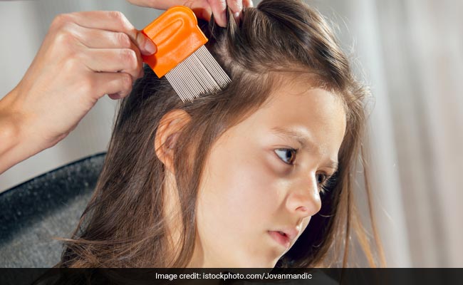 Parenting Tips: बच्चे के बालों में पड़ गई हैं जुएं, छुटकारा पाने के लिए ट्राय करें ये घरेलू नुस्खे