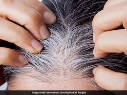सफेद बालों को जड़ से काला करने में मदद करेंगे ये देसी नुस्खे, फिर कभी नहीं लगानी पड़ेगी मेहंदी और डाई सफेद बालों को जड़ से काला करने में मदद करेंगे ये देसी नुस्खे, फिर कभी नहीं लगानी पड़ेगी मेहंदी और डाई