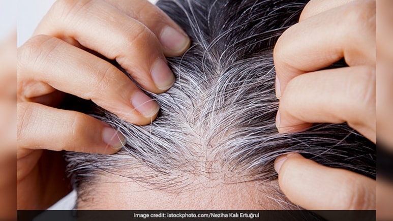 बालों को जड़ से काला करने में मदद करेंगी आपके किचन में मौजूद ये 4 चीजें, जानें बनाने और इस्तेमाल करने का तरीका, कभी नहीं लगानी पड़ेगी डाई