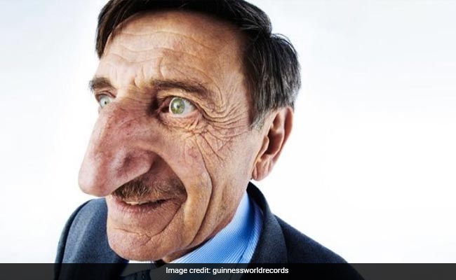 मिलिए दुनिया के सबसे लंबी नाक वाले इंसान से, गिनीज़ वर्ल्ड रिकॉर्ड में इनका नाम दर्ज़ है