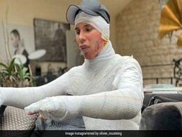 Balmain Director Shares Moving Post On Fireplace Explosion Injuries: "I Was Ashamed" Balmain Director Shares Moving Post On Fireplace Explosion Injuries: "I Was Ashamed"