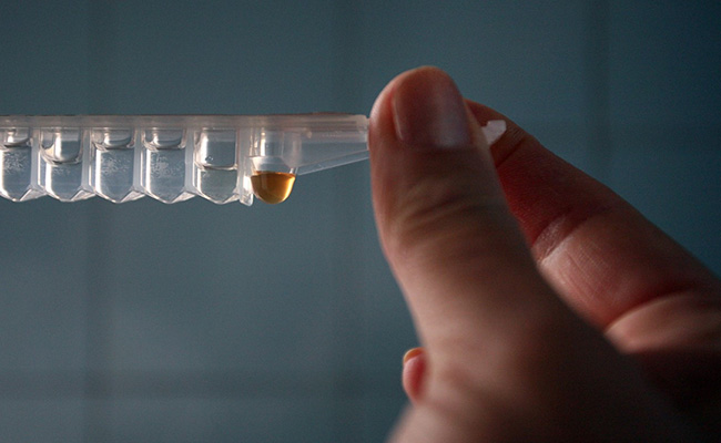 New "Highly Virulent" Strain Of HIV Discovered In The Netherlands