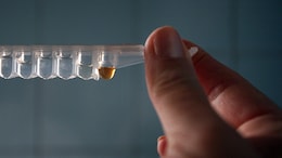 "Don't Want To Die": Lesotho HIV Patients Look To Traditional Medicine