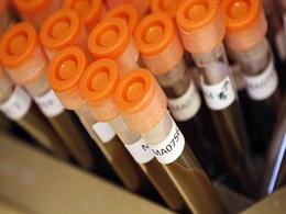 Antibiotics Misuse Helping Bacteria Develop Resistance: Health Agency Antibiotics Misuse Helping Bacteria Develop Resistance: Health Agency