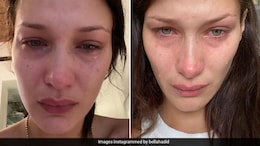 What Is Lyme Disease? Understanding Transmission, Diagnosis, And Symptoms After Bella Hadid's Revelation