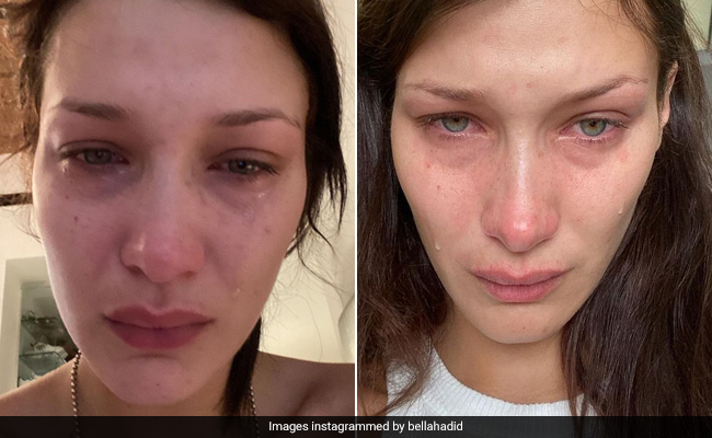 Bella Hadid battle with chronic Lyme disease has highlighted on how long it can last