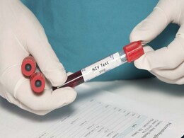 मिजोरम में एचआईवी-एड्स के मामलों का प्रतिशत देश में सर्वाधिक: अधिकारी मिजोरम में एचआईवी-एड्स के मामलों का प्रतिशत देश में सर्वाधिक: अधिकारी