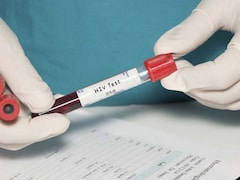 Haryana Screens 12.4 Lakh People For HIV In 2025-25, 5,877 Found Positive