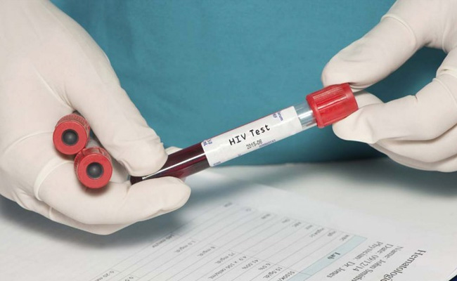 Haryana Screens 12.4 Lakh People For HIV In 2025-25, 5,877 Found Positive