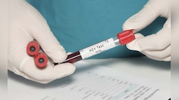 US Aid Cuts Halt HIV Vaccine Research In South Africa, With Global Impact