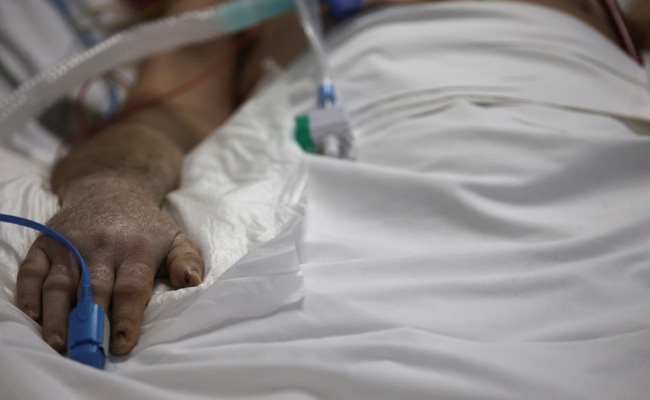 UK Calls Out Racial Bias In Oximeter Device Used To Assess Covid Patients