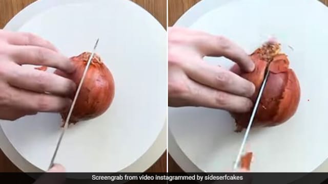 Onion juice has a good amount of sulphur, which nourishes the hair