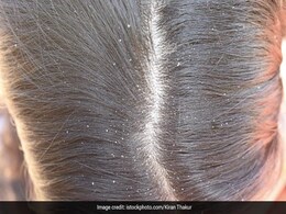Dandruff and Hair fall: सर्दी में कर रहे हैं ये गलती तो सिर में हो सकती है डैंड्रफ, झड़ने लगेंगे बाल Dandruff and Hair fall: सर्दी में कर रहे हैं ये गलती तो सिर में हो सकती है डैंड्रफ, झड़ने लगेंगे बाल