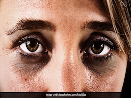 Skin care in summers : चेहरे की झाईं और डार्क सर्कल को इन घरेलू नुस्खों से करें कम, जल्द दिखने लगेगा असर Skin care in summers : चेहरे की झाईं और डार्क सर्कल को इन घरेलू नुस्खों से करें कम, जल्द दिखने लगेगा असर
