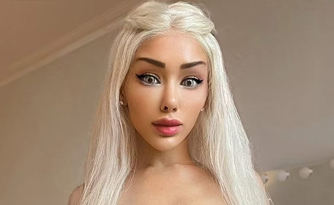 डॉल दिखने के लिए खर्च की लाखों की रकम, अब फिर से पहले जैसा लुक पाने की कोशिश में लगी मॉडल