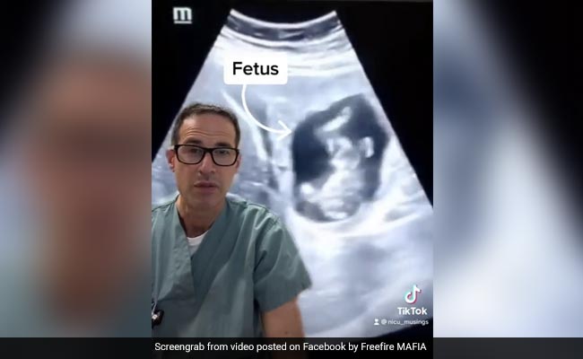 Foetus Found Inside Woman's Liver In "Extremely Rare" Pregnancy