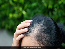 Hair Care: कम उम्र में हो रहे हैं बाल सफेद न हो परेशान, आजमाइए ये घरेलू उपाय Hair Care: कम उम्र में हो रहे हैं बाल सफेद न हो परेशान, आजमाइए ये घरेलू उपाय