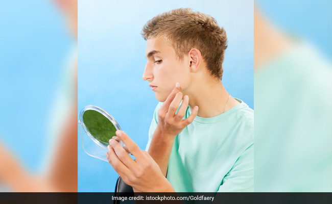 Pimple Patch Price In India: Top Brands To Buy From