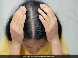 Hair Fall की वजह आयरन की कमी तो नहीं, जानें Iron की कमी के लक्षण, Risks और फूड सोर्स Hair Fall की वजह आयरन की कमी तो नहीं, जानें Iron की कमी के लक्षण, Risks और फूड सोर्स