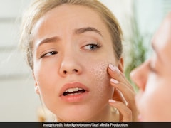 Winter Home Remedies: बहुत ज्यादा ड्राई स्किन है तो क्या करें?