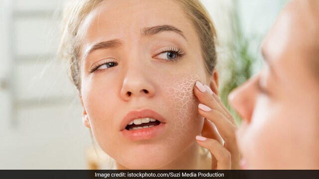 Using lemon and tomatoes directly on the skin can make our skin dry out and crack