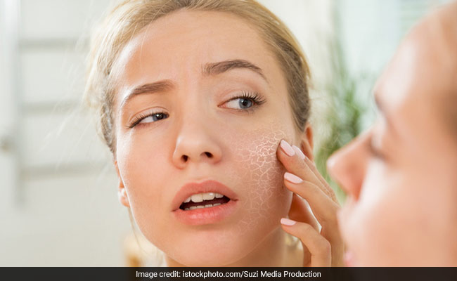 Using lemon and tomatoes directly on the skin can make our skin dry out and crack