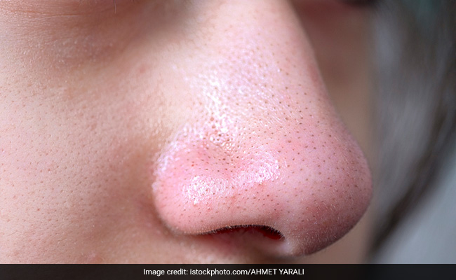 Blackheads Home Remedies: ब्लैकहेड्स से छुटकारा पाने के लिए घर पर ही बनाइए ये 4 स्क्रब, तुरंत दिखेगा असर
